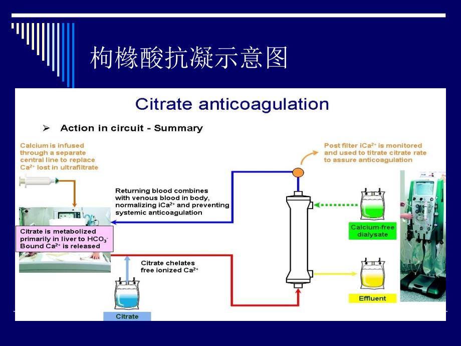 CRRT的枸橼酸抗凝课件.ppt_第4页