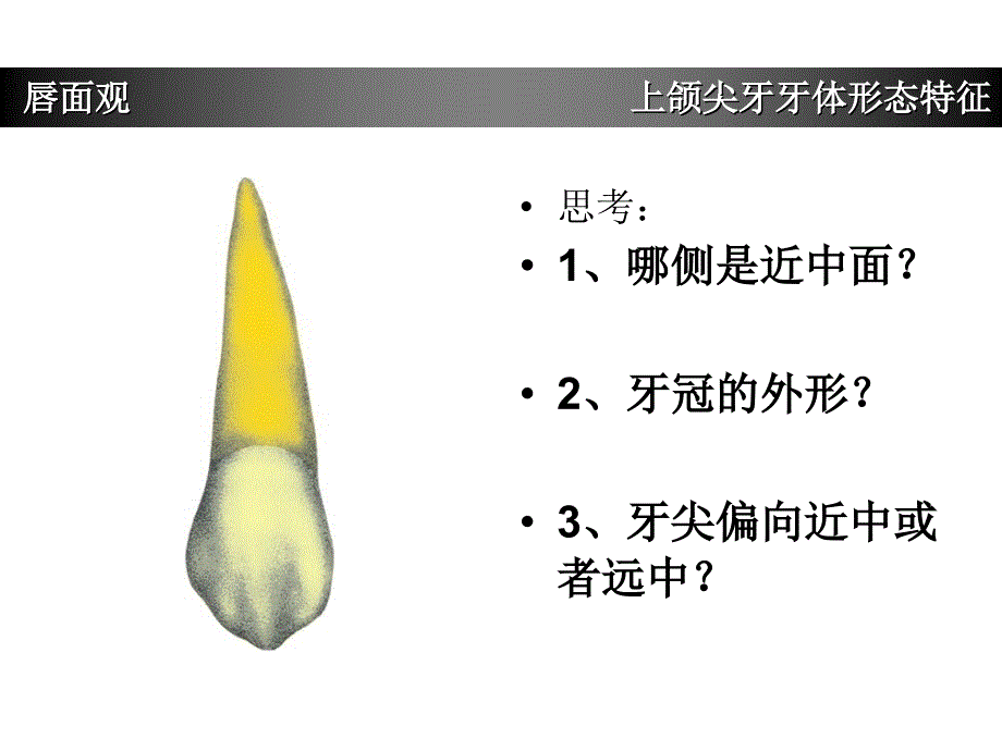 上颌尖牙牙体形态简述_第3页