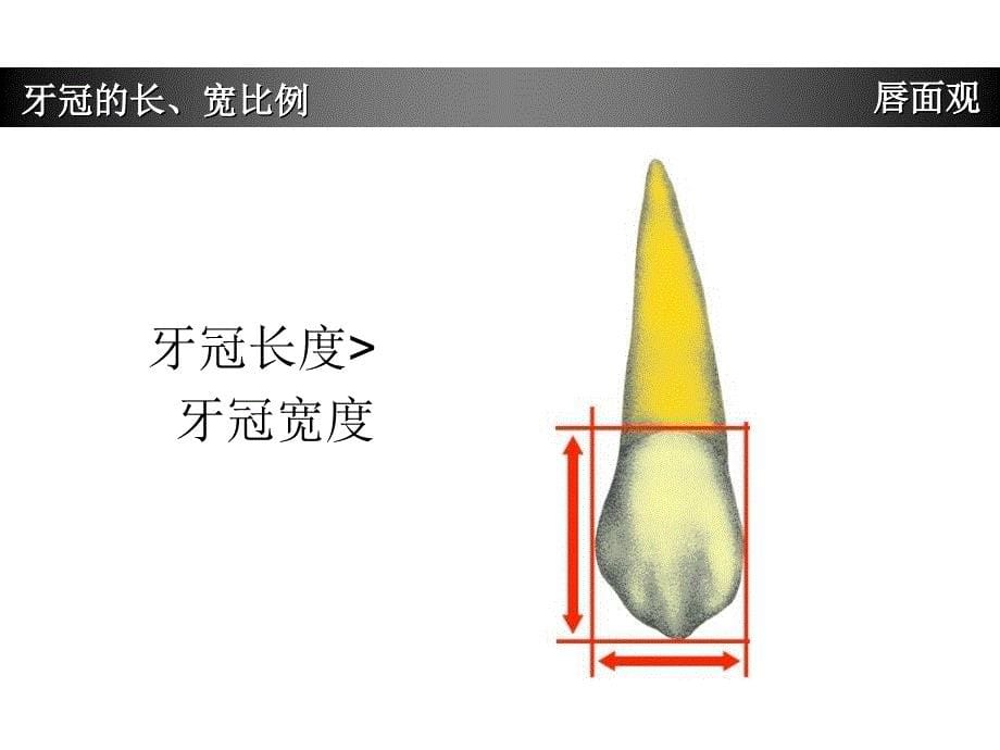 上颌尖牙牙体形态简述_第5页