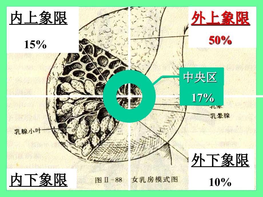 病理学课件乳腺癌_第3页