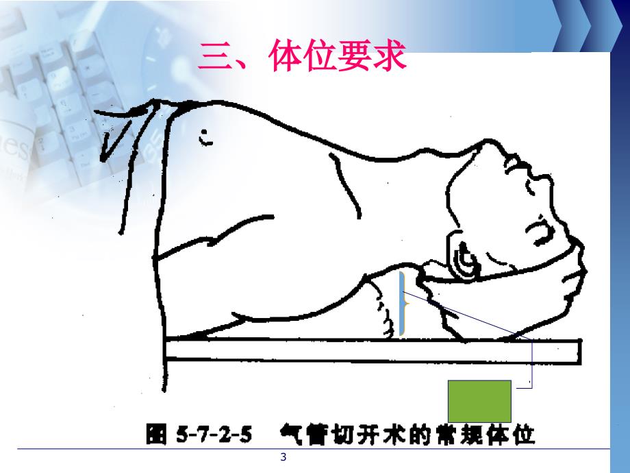 气管切开病人的护理PPT课件-(1)(1)知识讲解_第3页