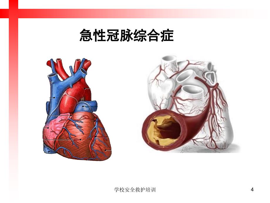 学校安全救护培训课件_第4页