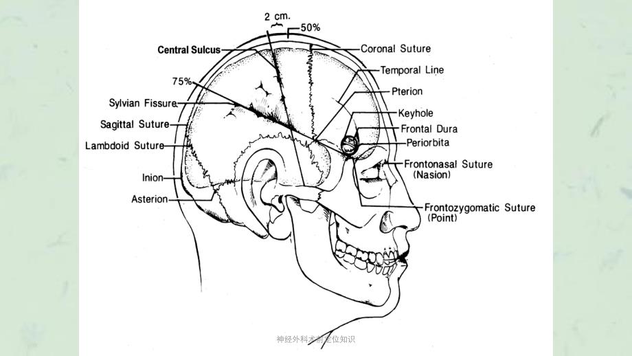 神经外科术前定位知识课件_第4页