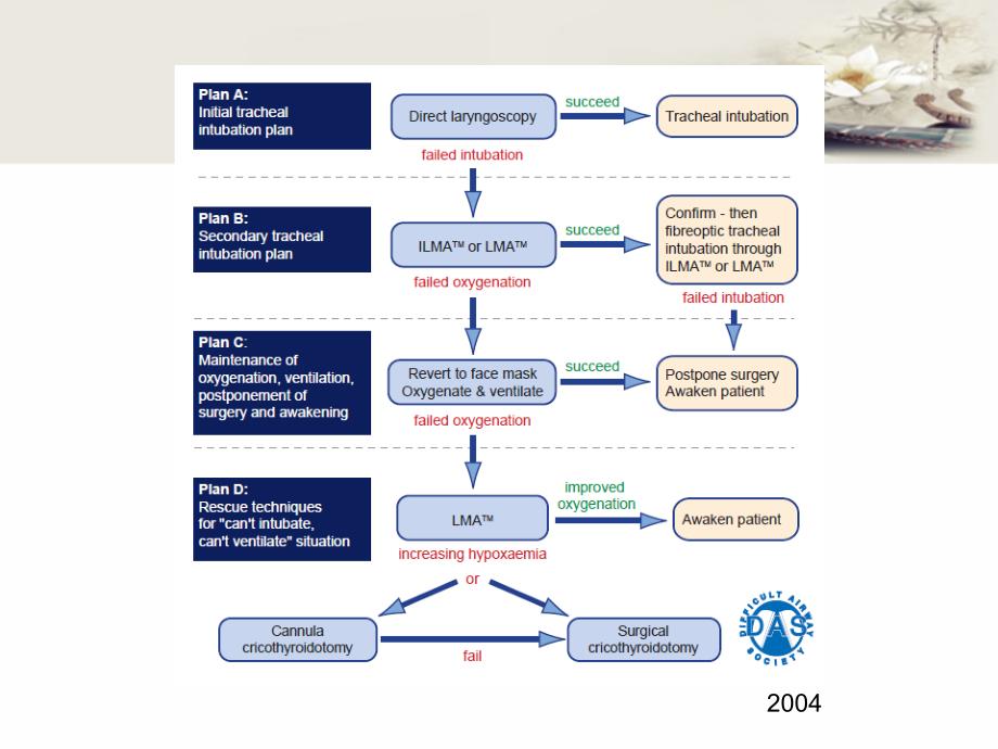 DAS成人未预料的困难气道指南解读DELE课件_第3页