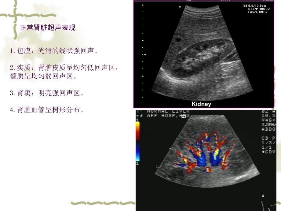 泌尿系超声ppt课件_第4页