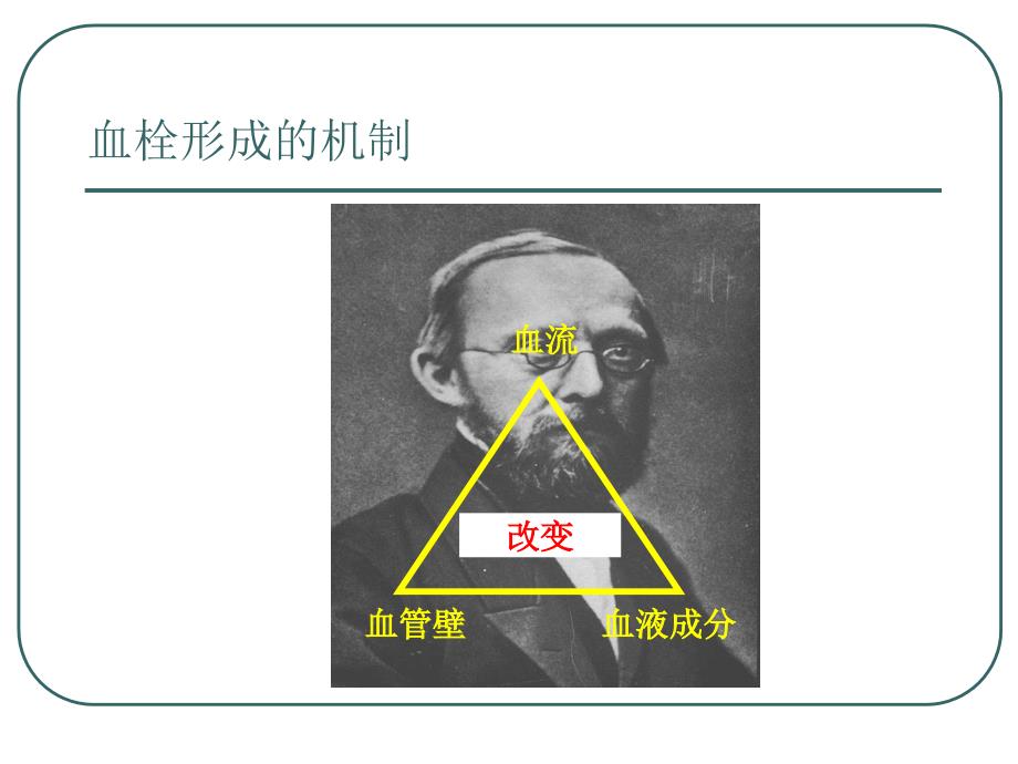 抗凝药物的发展普通肝素戊糖精品PPT_第3页