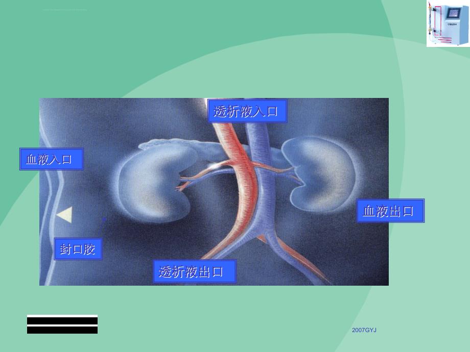 透析器材料以及性能特点_第3页