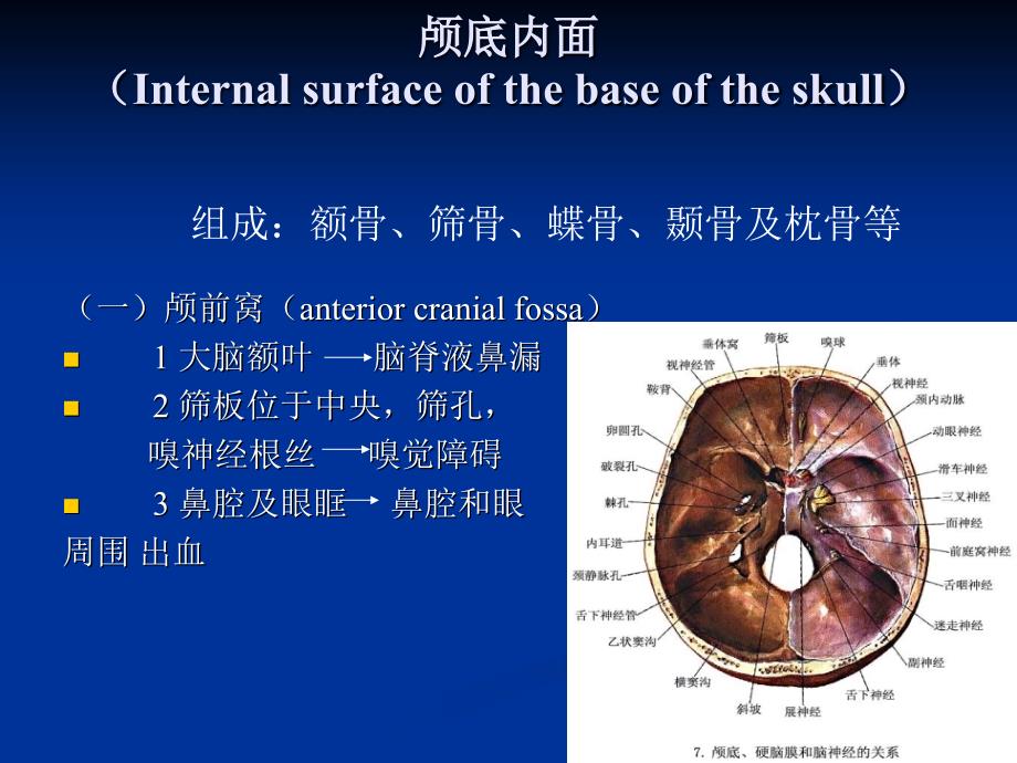 颅底神经解剖和常见综合征课件.ppt_第3页