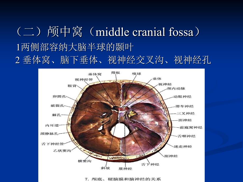 颅底神经解剖和常见综合征课件.ppt_第4页