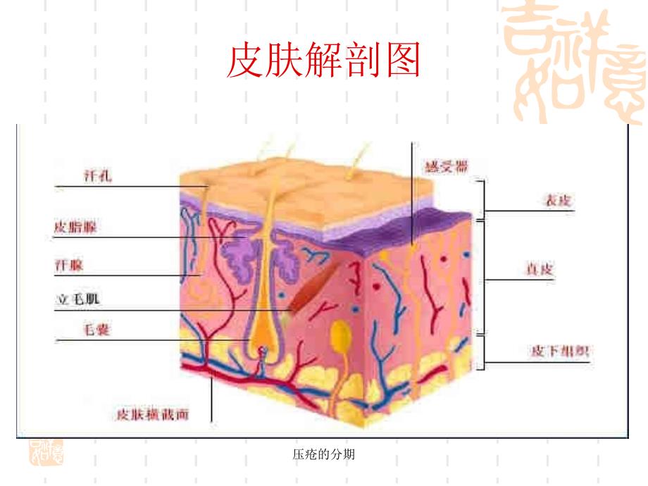 压疮的分期课件_第4页