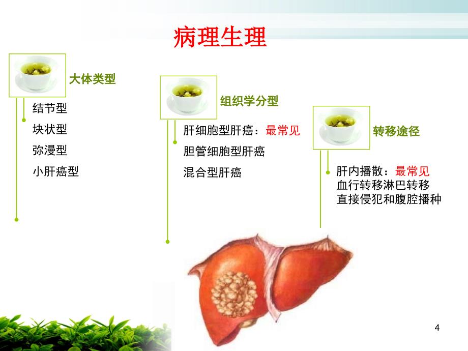 原发性肝癌病人的护理ppt课件_第4页