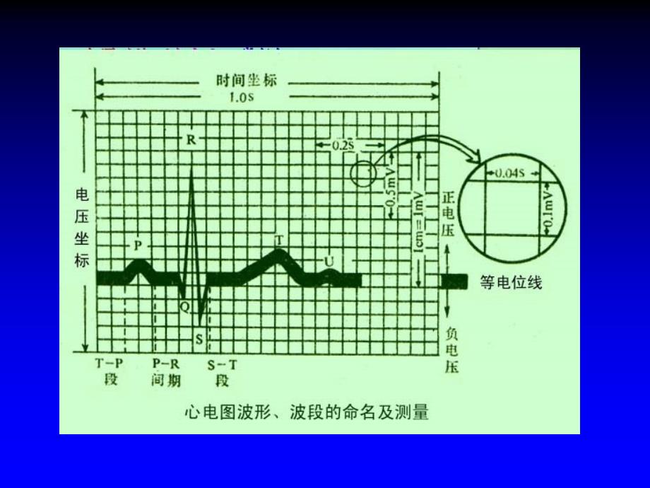 c第二节正常心电图_第2页