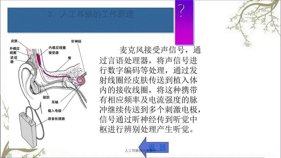 人工耳蜗植入术简介_第5页