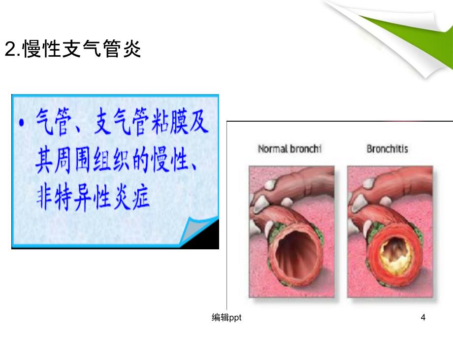 慢阻肺最新版本_第4页