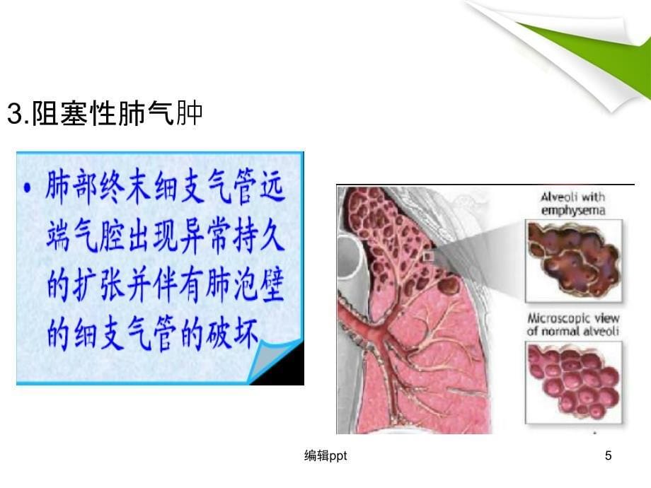 慢阻肺最新版本_第5页