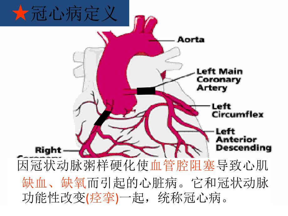 内科护理-冠状动脉硬化性心脏病的护理PPT课件02_第4页