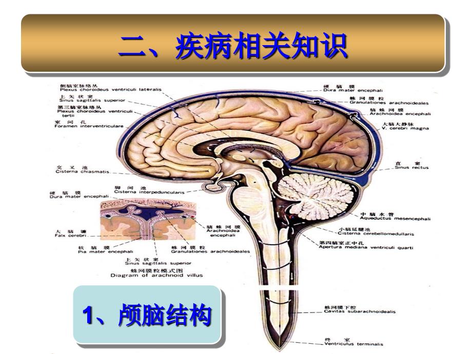 蛛网膜下腔出血的护理查房_第3页