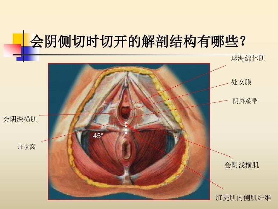 会阴切开缝合_第5页