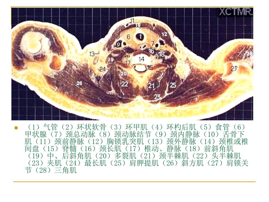 人体断层解剖图谱胸腔_第2页