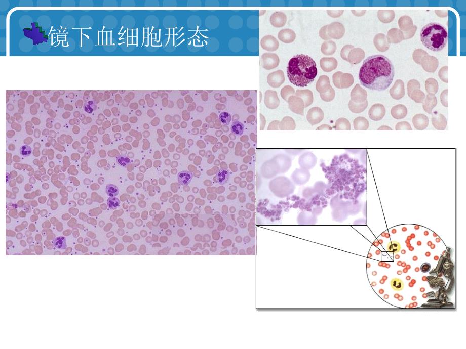 常用血液分析指标.ppt_第4页