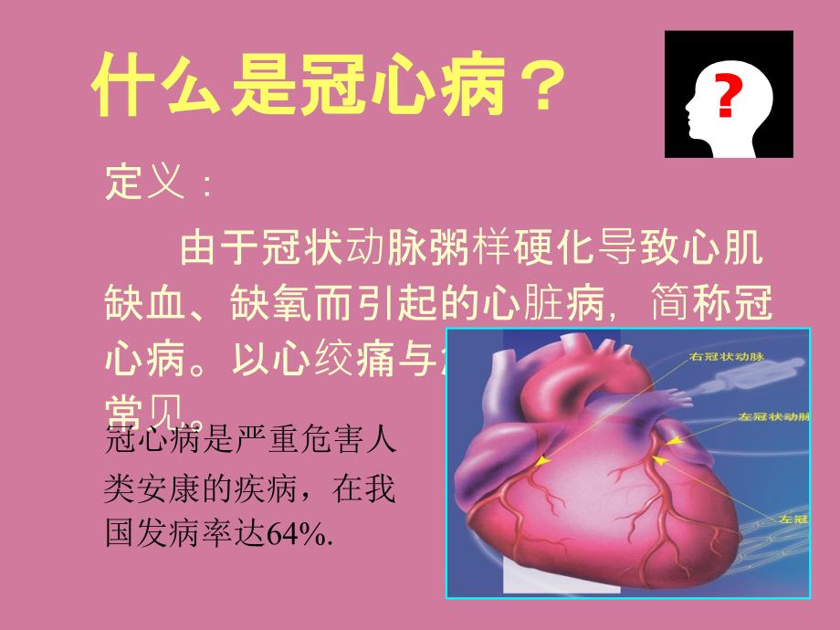 认识冠心病PPT课件_第2页