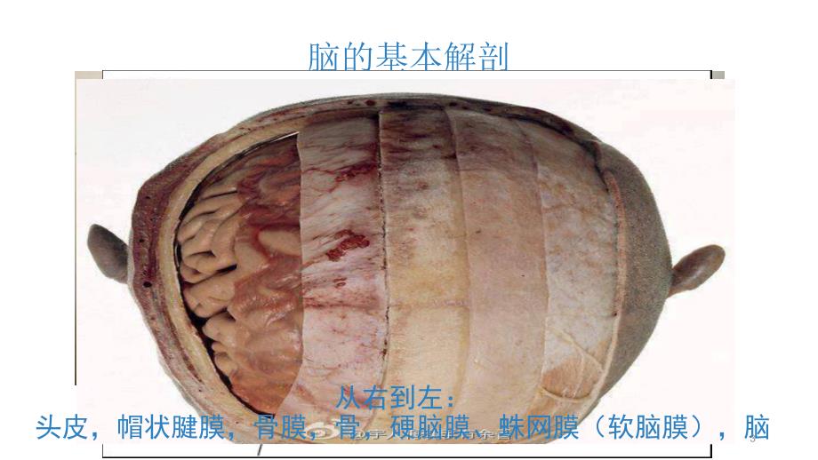 神经外科引流管的护理ppt课件_第3页