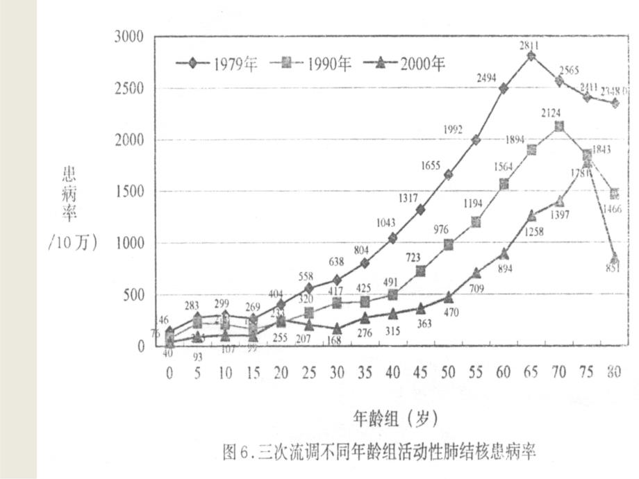 儿童结核诊断和治疗进展.ppt_第3页