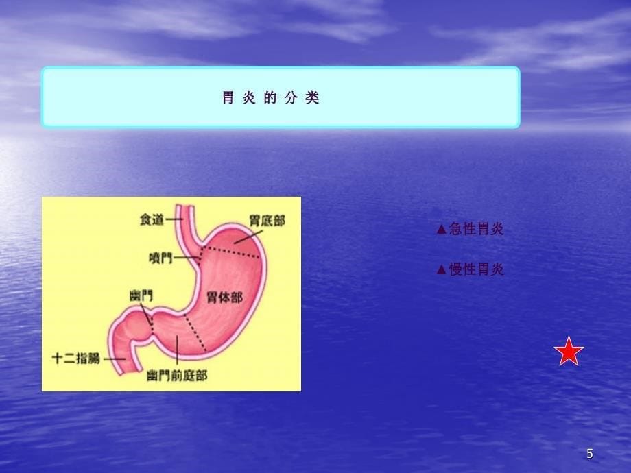 慢性胃炎护理查房ppt课件_第5页