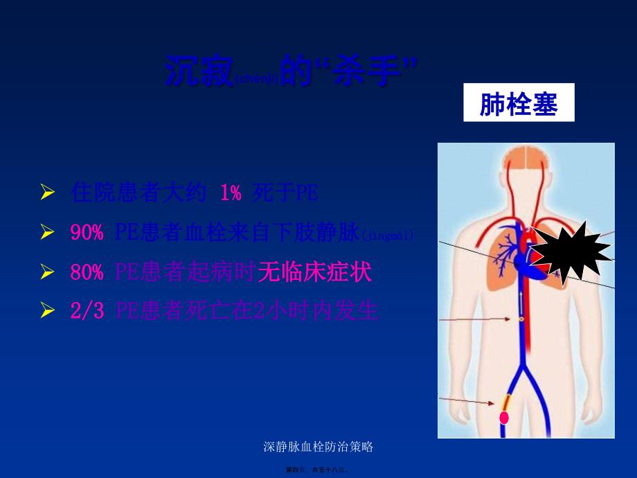 深静脉血栓防治策略课件_第4页