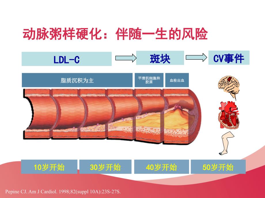 动脉粥样硬化的形成、危害及干预措施_第4页