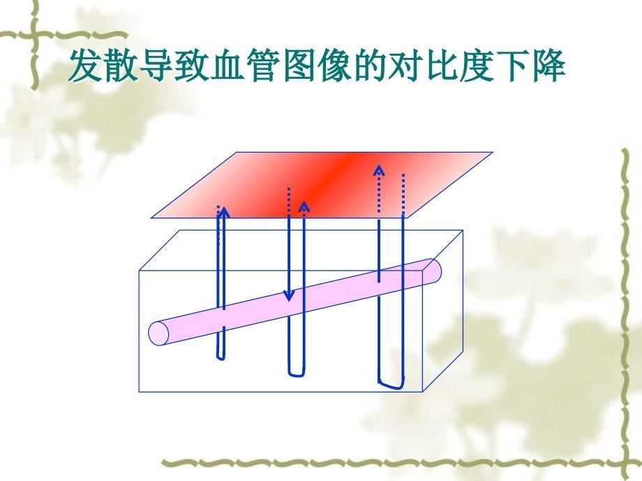 窄带成像NBI在内镜诊疗中的应用_第5页