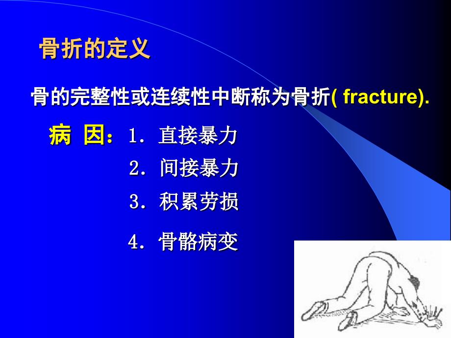 《骨折病人的护理》PPT课件_第3页