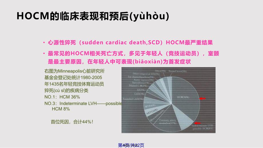 CRT治疗肥厚型梗阻性心肌病实用教案_第4页