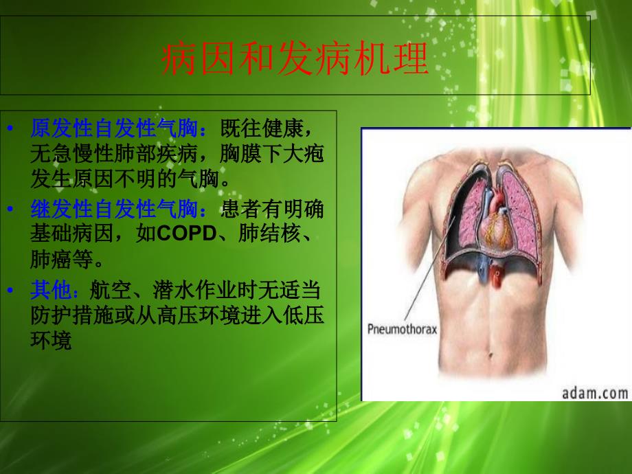 自发性气胸围手术期护理_第4页