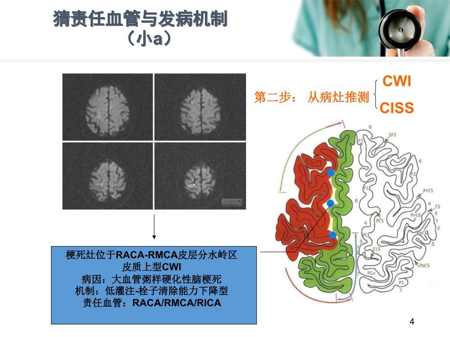 （优质课件）从影像学梗死部位推测责任供血血管_第4页