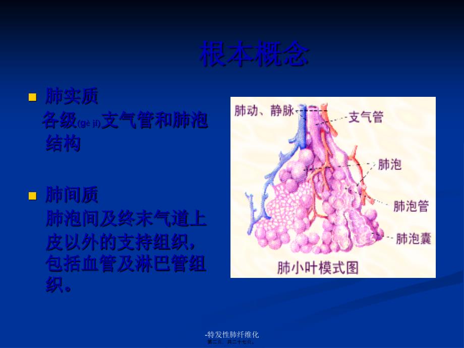 -特发性肺纤维化课件_第2页