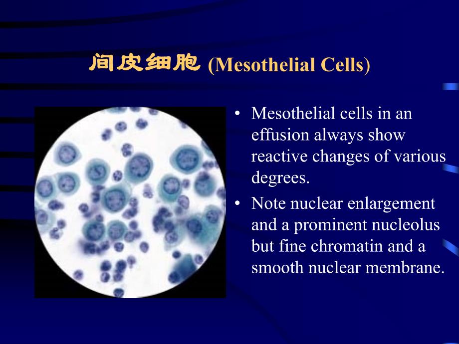 4浆膜腔积液脱落细胞学形态_第4页