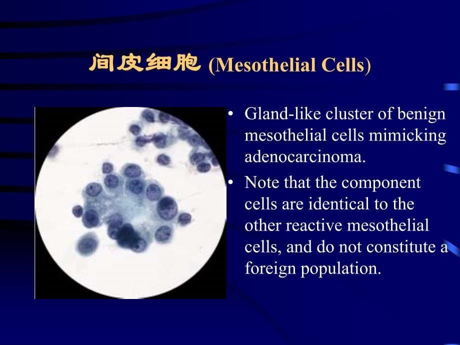 4浆膜腔积液脱落细胞学形态_第5页