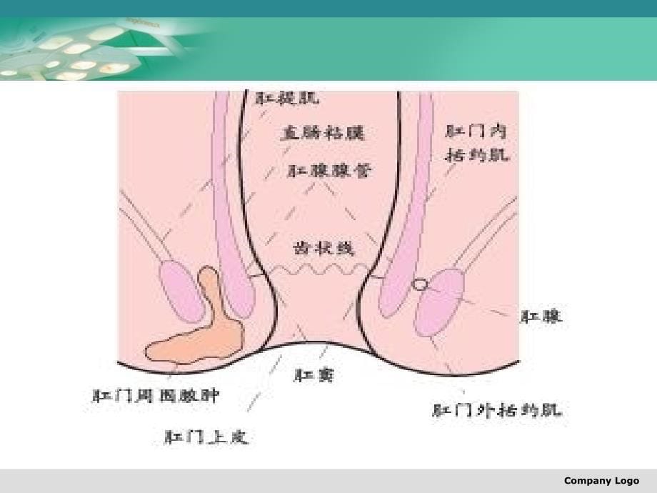 第六节直肠、肛管良性疾病病人的护理_第5页