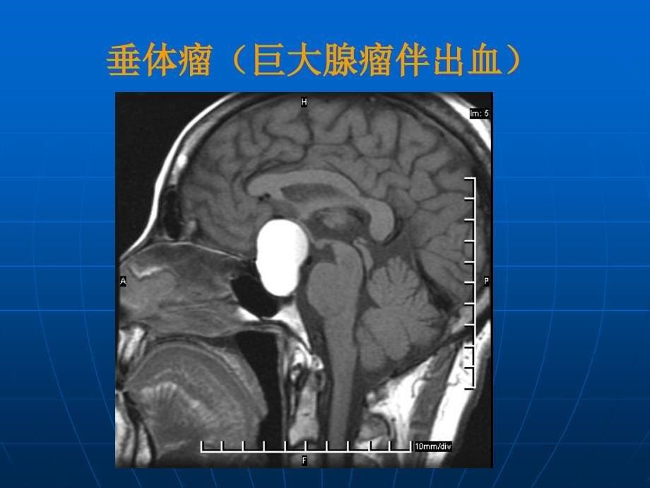 神经病学-大脑、小脑、脊髓的结构和功能.ppt_第5页