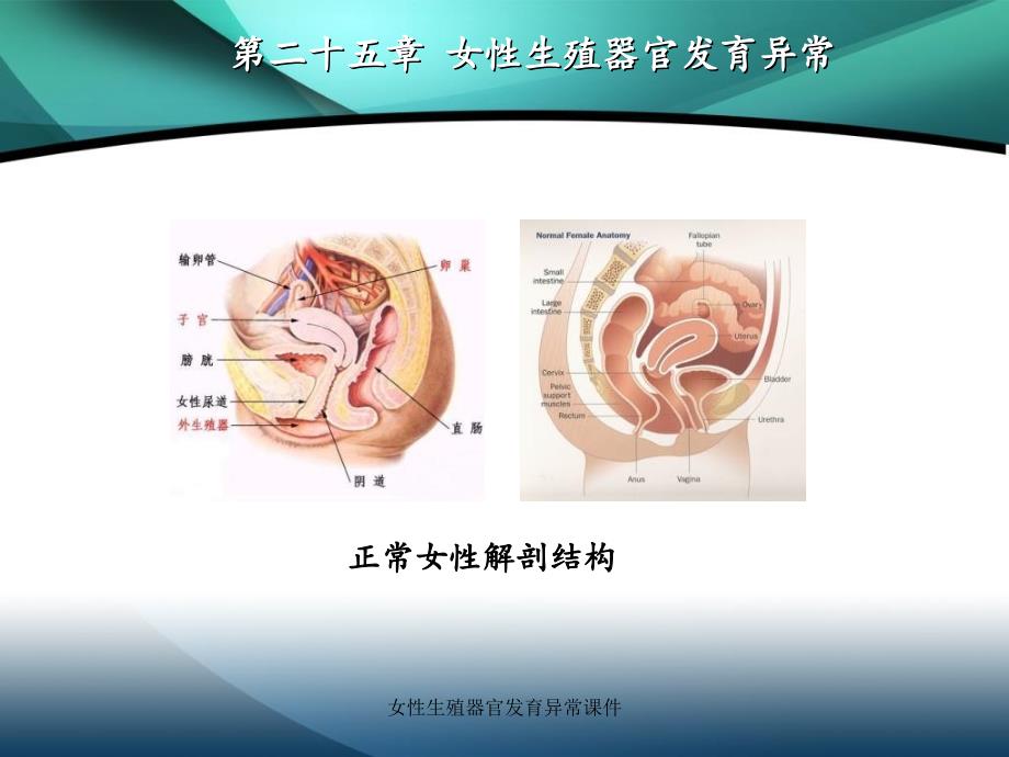 女性器官发育异常课件_第3页