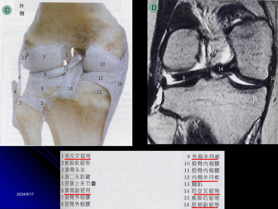 膝关节解剖及MRI诊断课件_第3页