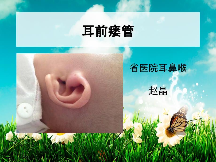 耳前瘘管课件