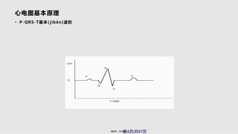 EKG心电生理实用教案_第4页