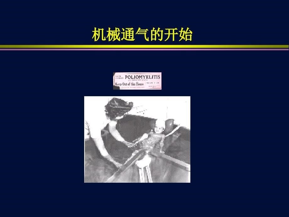 机械通气总论ppt课件_第5页