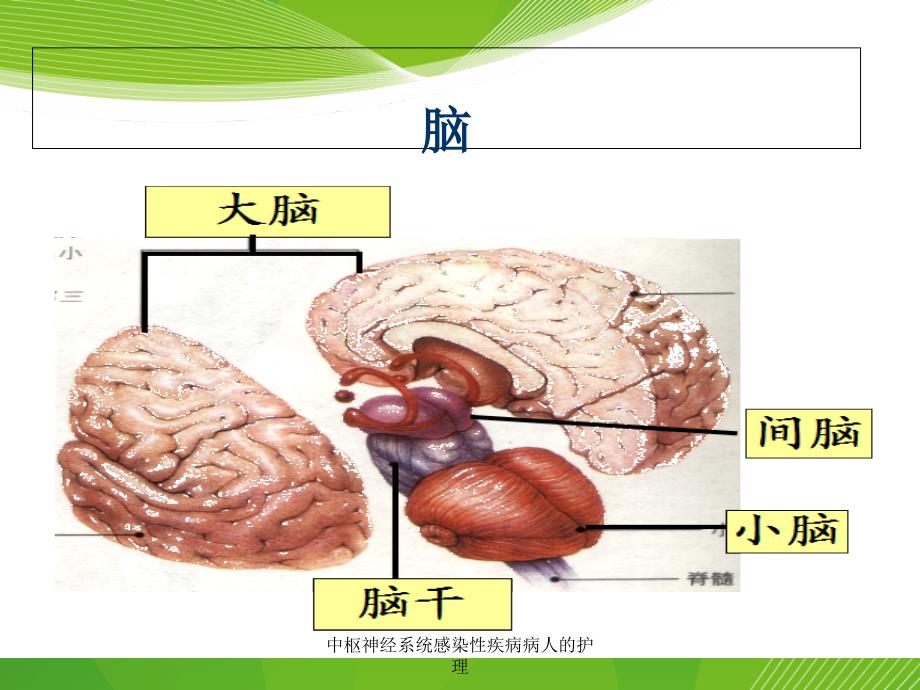 中枢神经系统感染性疾病病人的护理课件_第4页