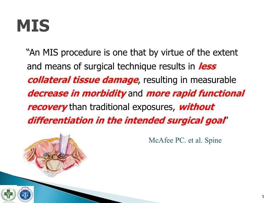 MISTLIF治疗腰椎峡部性滑脱PPT参考幻灯片_第5页