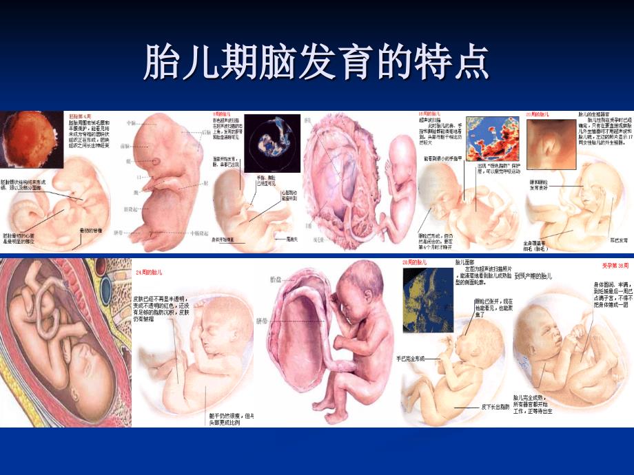 围产期因素与脑损伤ppt-.课件_第2页