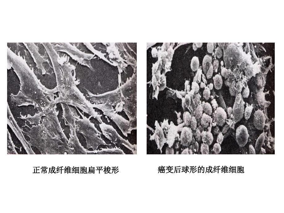 细胞的癌变_第5页