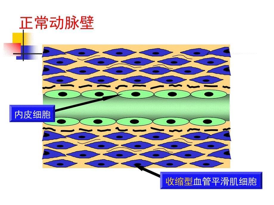 急性冠脉综合征的治疗策略_第5页